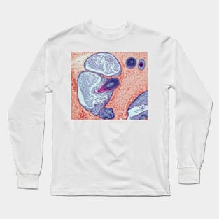 Dermoid ovarian cyst, light micrograph (C019/9256) Long Sleeve T-Shirt